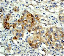 Immunohistochemistry (Formalin/PFA-fixed paraffin-embedded sections) - Anti-FAK antibody [EP695Y] - BSA and Azide free (AB271836)