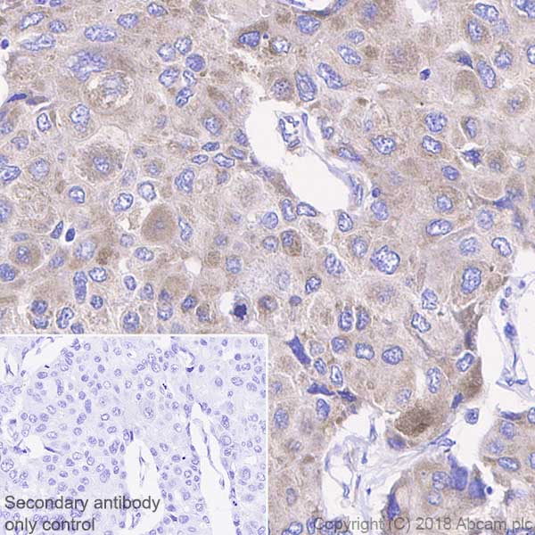 Immunohistochemistry (Formalin/PFA-fixed paraffin-embedded sections) - Anti-FAK antibody [EP695Y] - BSA and Azide free (AB271836), expandable thumbnail