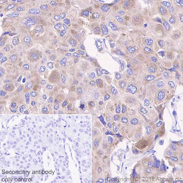 Immunohistochemistry (Formalin/PFA-fixed paraffin-embedded sections) - Anti-FAK antibody [EP695Y] - BSA and Azide free (AB271836)