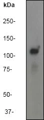 Western blot - Anti-FAK antibody [EP695Y] - BSA and Azide free (AB271836)