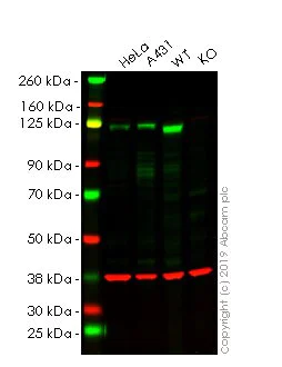 Western blot - Anti-FAK antibody [EP695Y] - BSA and Azide free (AB271836)