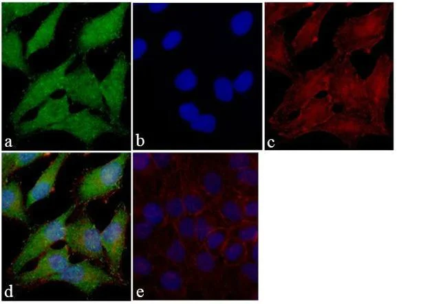 Immunocytochemistry/ Immunofluorescence - Anti-FAK antibody [RP23040020] (AB307996)