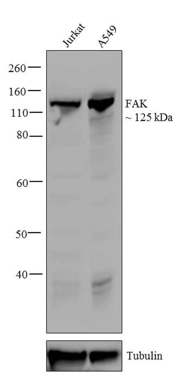 Western blot - Anti-FAK antibody [RP23040020] (AB307996)