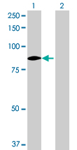 Western blot - FAK overexpression 293T lysate (whole cell) (AB94321)