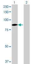 Western blot - FAK overexpression 293T lysate (whole cell) (AB94321)