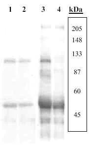 Western blot - Anti-FAK (phospho S732) antibody (AB4792)