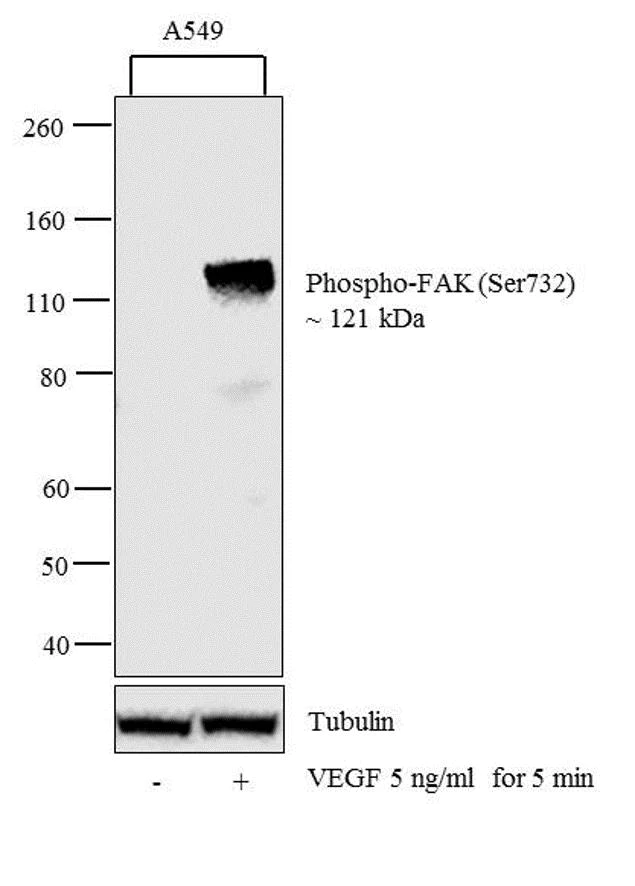 Western blot - Anti-FAK (phospho S732) antibody (AB4792)