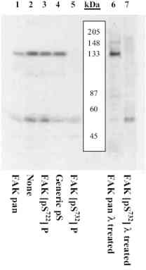 Western blot - Anti-FAK (phospho S732) antibody (AB4792), expandable thumbnail