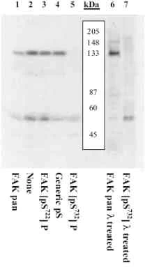 Western blot - Anti-FAK (phospho S732) antibody (AB4792)
