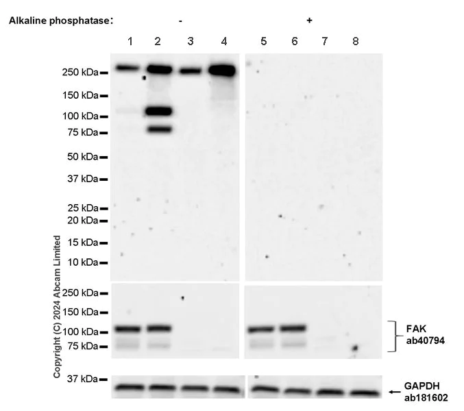Western blot - Anti-FAK (phospho S732) antibody [EPR26074-44] (AB322920)