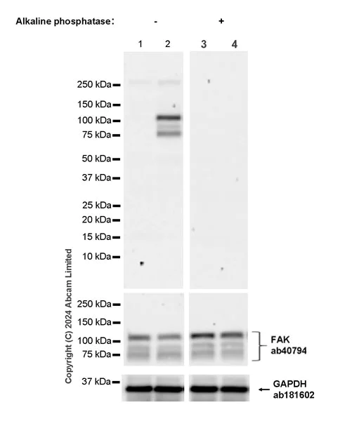 Western blot - Anti-FAK (phospho S732) antibody [EPR26074-44] (AB322920)