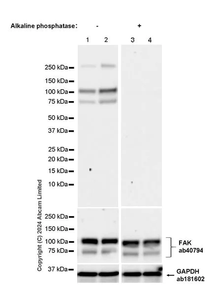 Western blot - Anti-FAK (phospho S732) antibody [EPR26074-44] (AB322920)