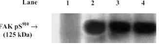 Western blot - Anti-FAK (phospho S910) antibody (AB4794), expandable thumbnail