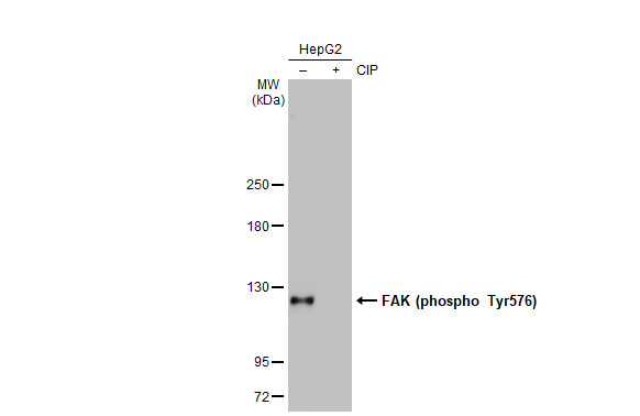 Western blot - Anti-FAK phospho Tyr576 antibody [HL127] (AB308332), expandable thumbnail