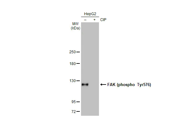 Western blot - Anti-FAK phospho Tyr576 antibody [HL127] (AB308332)