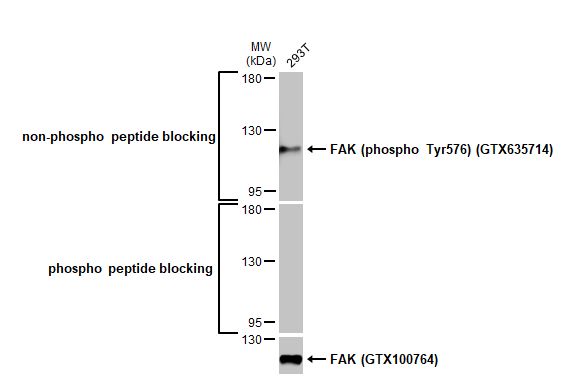 Western blot - Anti-FAK phospho Tyr576 antibody [HL127] (AB308332), expandable thumbnail