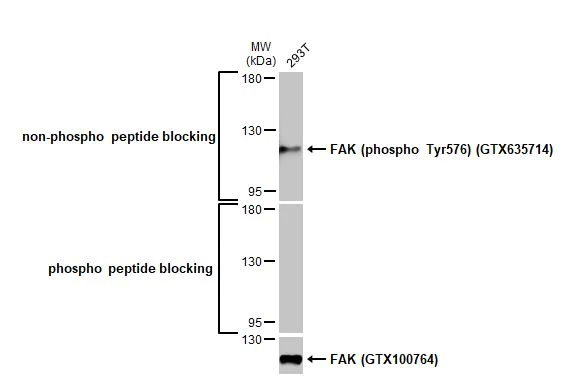 Western blot - Anti-FAK phospho Tyr576 antibody [HL127] (AB308332)