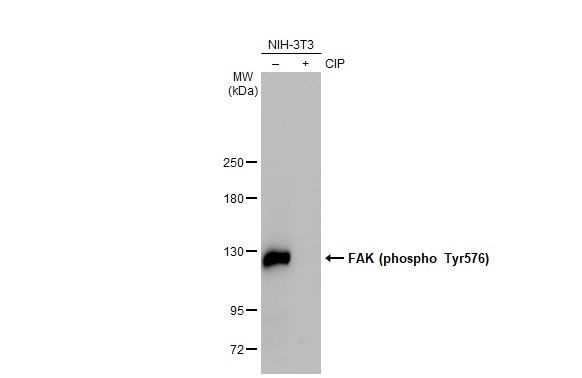 Western blot - Anti-FAK phospho Tyr576 antibody [HL127] (AB308332), expandable thumbnail