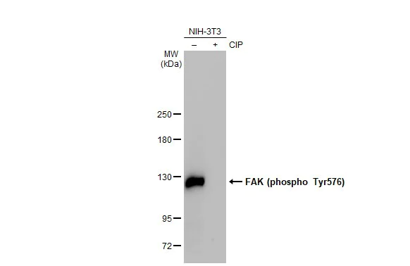 Western blot - Anti-FAK phospho Tyr576 antibody [HL127] (AB308332)