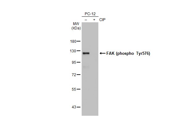 Western blot - Anti-FAK phospho Tyr576 antibody [HL127] (AB308332), expandable thumbnail