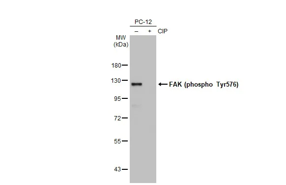 Western blot - Anti-FAK phospho Tyr576 antibody [HL127] (AB308332)