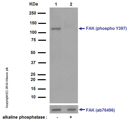 Western blot - Anti-FAK (phospho Y397) antibody [EP2160Y] (AB81298)