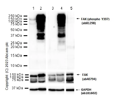 Anti-FAK (phospho Y397) antibody [EP2160Y] (ab81298) | Abcam