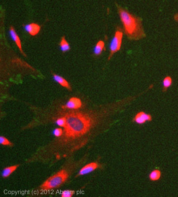 Immunocytochemistry/ Immunofluorescence - Anti-FAK (phospho Y397) antibody [EP2160Y] - BSA and Azide free (AB271862), expandable thumbnail