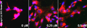 Immunocytochemistry/ Immunofluorescence - Anti-FAK (phospho Y397) antibody [EP2160Y] - BSA and Azide free (AB271862), expandable thumbnail