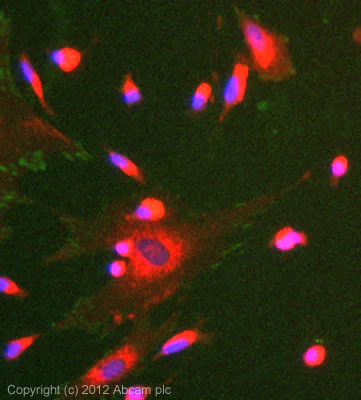 Immunocytochemistry/ Immunofluorescence - Anti-FAK (phospho Y397) antibody [EP2160Y] - Low endotoxin, Azide free (AB223529)