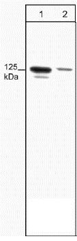 Western blot - Anti-FAK (phospho Y397) antibody [M121] (AB24781), expandable thumbnail