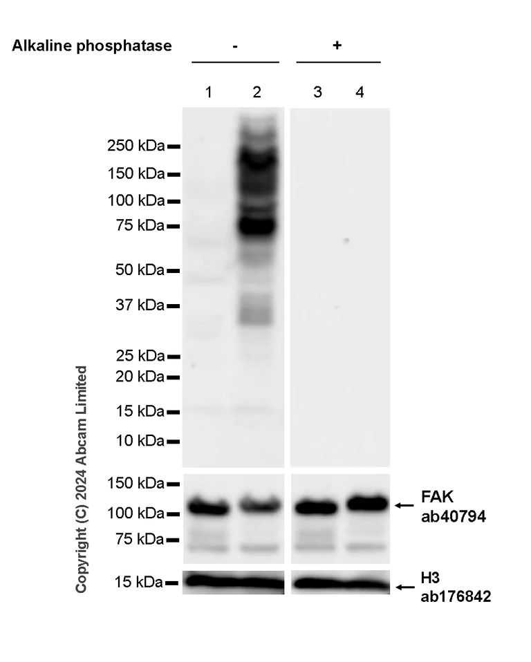 Western blot - Anti-FAK (phospho Y397 + Y576 + Y925) antibody [RM1141] (AB322354)