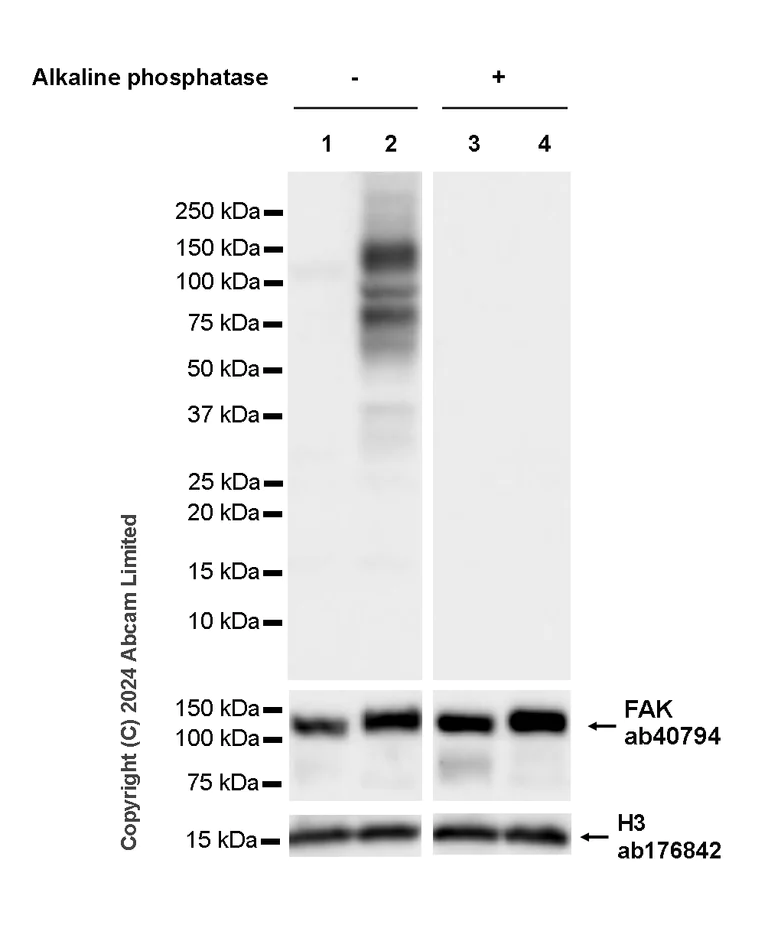 Western blot - Anti-FAK (phospho Y397 + Y576 + Y925) antibody [RM1141] (AB322354)