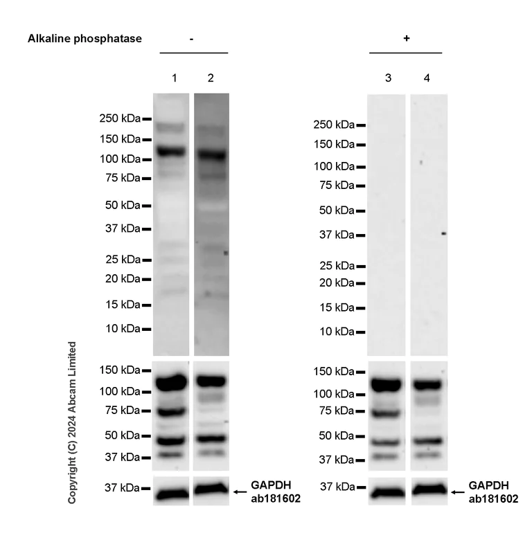 Western blot - Anti-FAK (phospho Y397 + Y576 + Y925) antibody [RM1141] (AB322354)