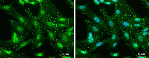 Immunocytochemistry/ Immunofluorescence - Anti-FAK (phospho Y576) antibody (AB226847)