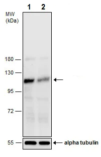 Western blot - Anti-FAK (phospho Y576) antibody (AB226847)