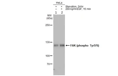 Western blot - Anti-FAK (phospho Y576) antibody (AB226847)