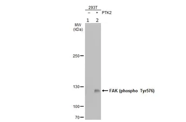 Western blot - Anti-FAK (phospho Y576) antibody (AB226847)
