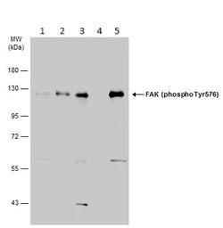 Western blot - Anti-FAK (phospho Y576) antibody (AB226847)