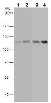 Western blot - Anti-FAK (phospho Y576) antibody (AB226847)