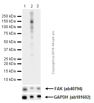 Western blot - Anti-FAK (phospho Y576) antibody [EP1897Y] (AB76120)