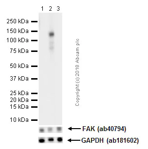 Western blot - Anti-FAK (phospho Y576) antibody [EP1897Y] (AB76120)