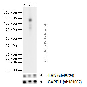 Western blot - Anti-FAK (phospho Y576) antibody [EP1897Y] - BSA and Azide free (AB247442), expandable thumbnail