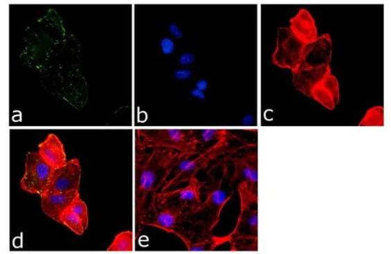 Immunocytochemistry - Anti-FAK (phospho Y861) antibody (AB4804)
