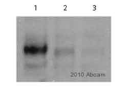 Western blot - Anti-FAK (phospho Y861) antibody (AB4804), expandable thumbnail