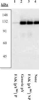Western blot - Anti-FAK (phospho Y861) antibody (AB4804)
