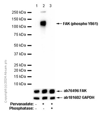 Western blot - Anti-FAK (phospho Y861) antibody [EP841Y] (AB81293), expandable thumbnail