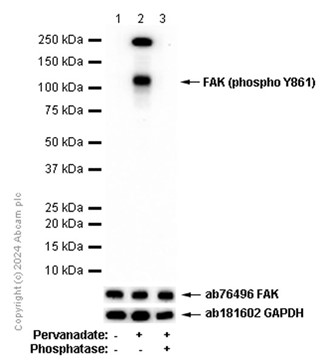 Western blot - Anti-FAK (phospho Y861) antibody [EP841Y] (AB81293), expandable thumbnail