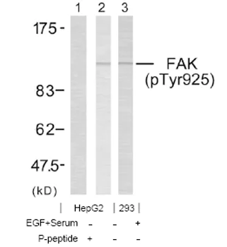 Western blot - Anti-FAK (phospho Y925) antibody (AB38512)