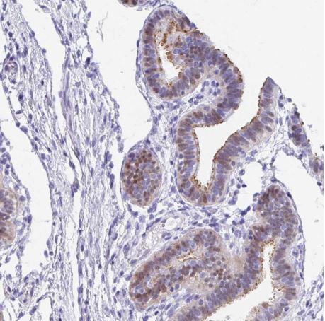 Immunohistochemistry (Formalin/PFA-fixed paraffin-embedded sections) - Anti-FAM107A antibody (AB185459)